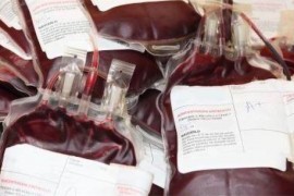 世界上最稀有的血型 Rhnull血型全球仅43人